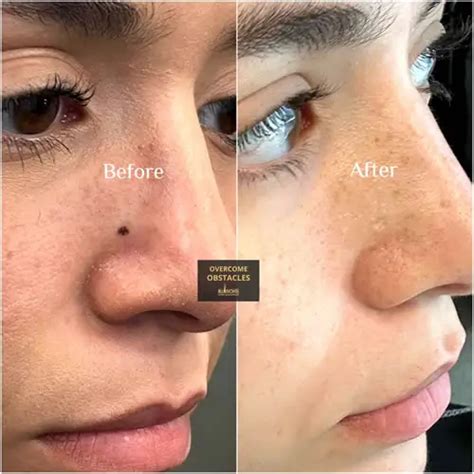 dallas best tattoo studio for scars|Paramedical Tattoos .
